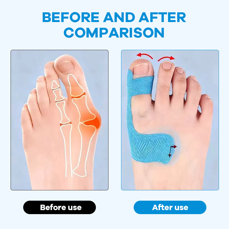 🔥52K+ Sold🦶Pre-cut Bunion Corrector Kinesiology Tape
