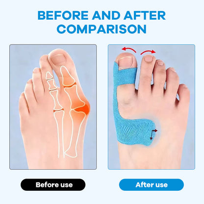 🔥52K+ Sold🦶Pre-cut Bunion Corrector Kinesiology Tape