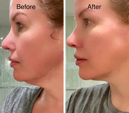 Lymphatic Face Brush + Free eBook